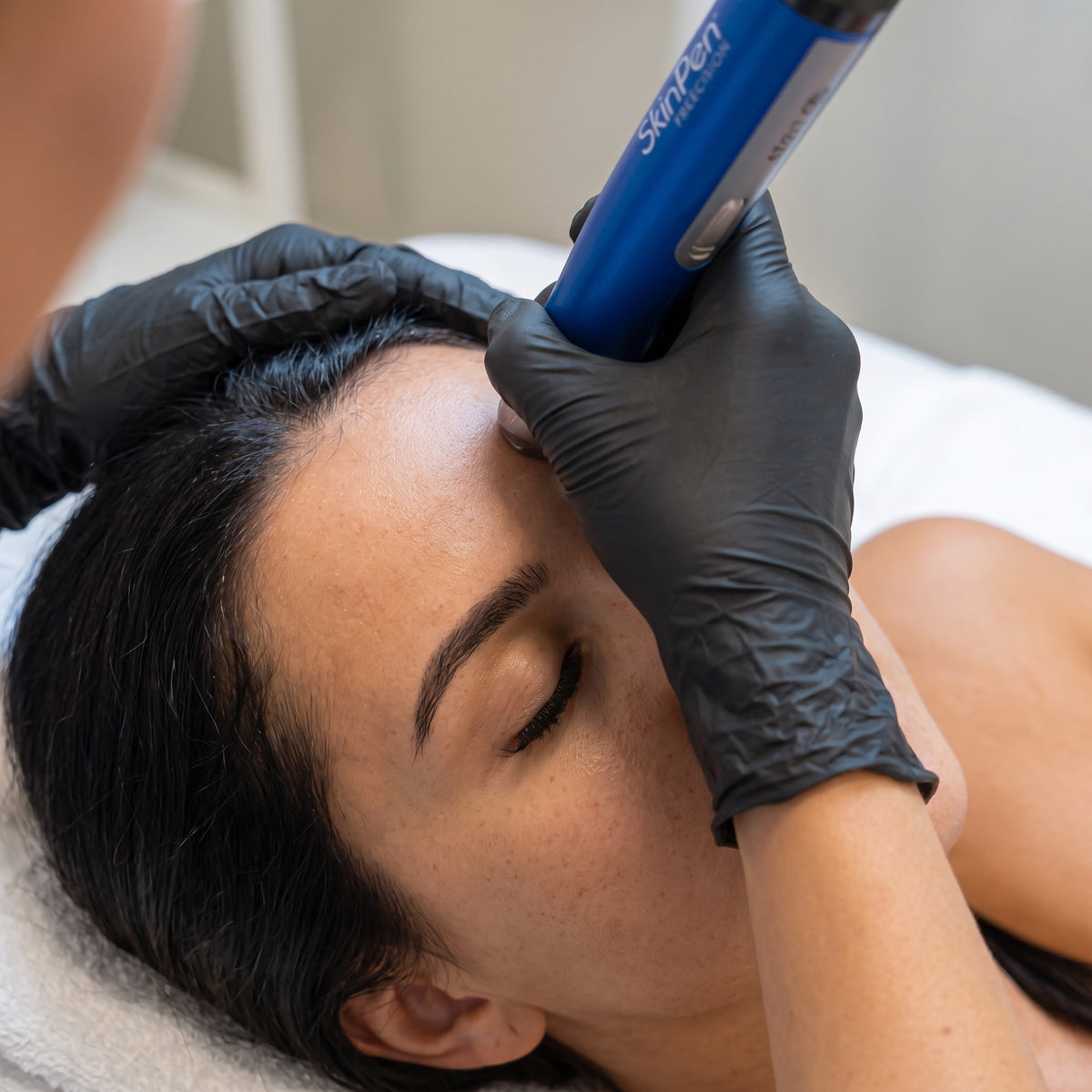 SKINPEN PRECISIÓN