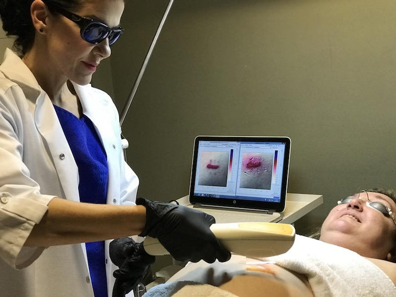 Eliminación de cicatrices y queloides con medicina estética