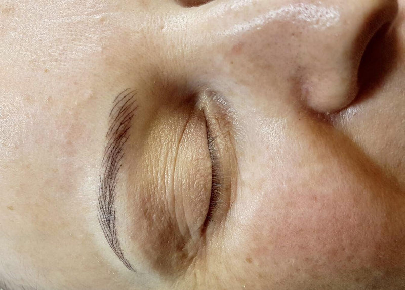 Tratamientos de medicina estética para pacientes con cáncer
