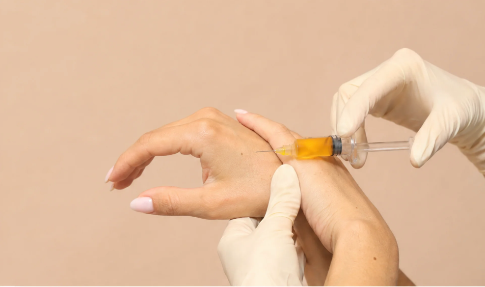 PRP (plasma enriquecido en plaquetas)