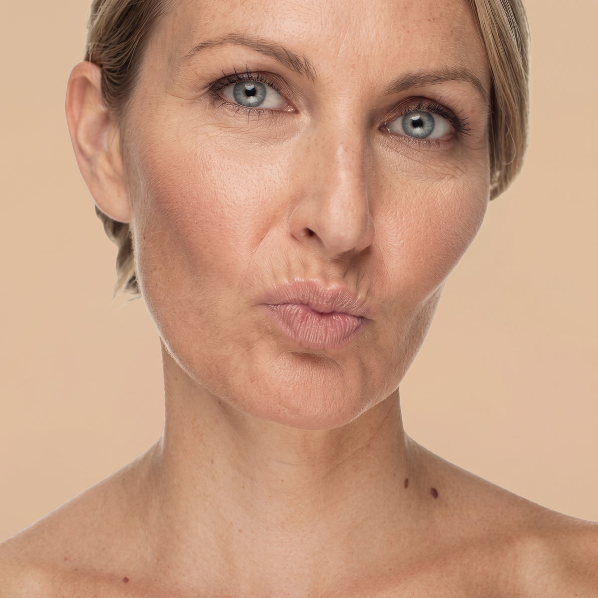 Arrugas código de barras en labio superior