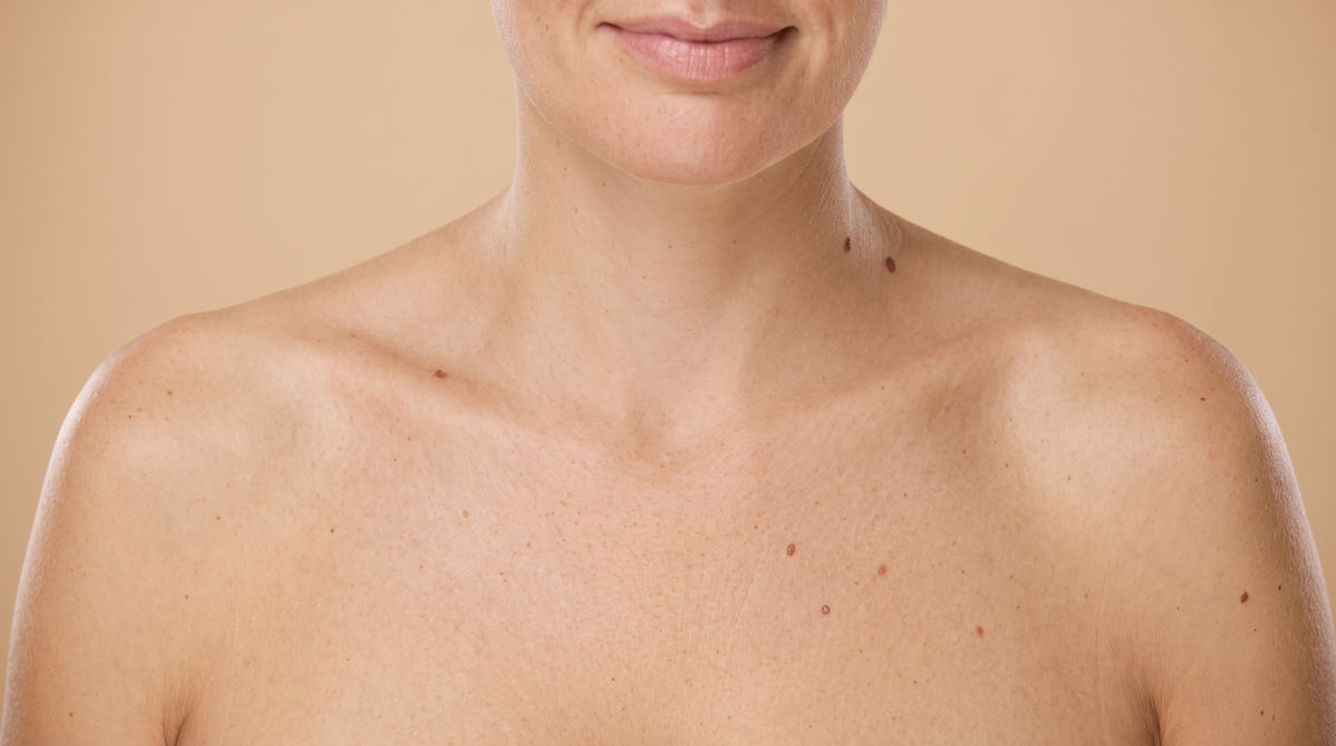 Arrugas en el cuello