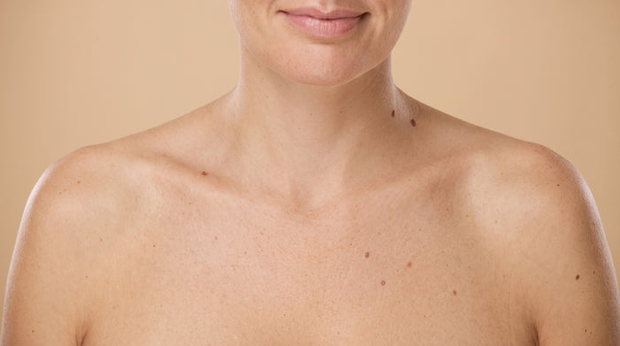 Arrugas en el cuello