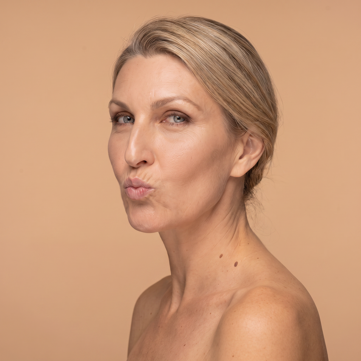 Arrugas código de barras en labio superior · Clínica Yolanda Albelda, Santiago