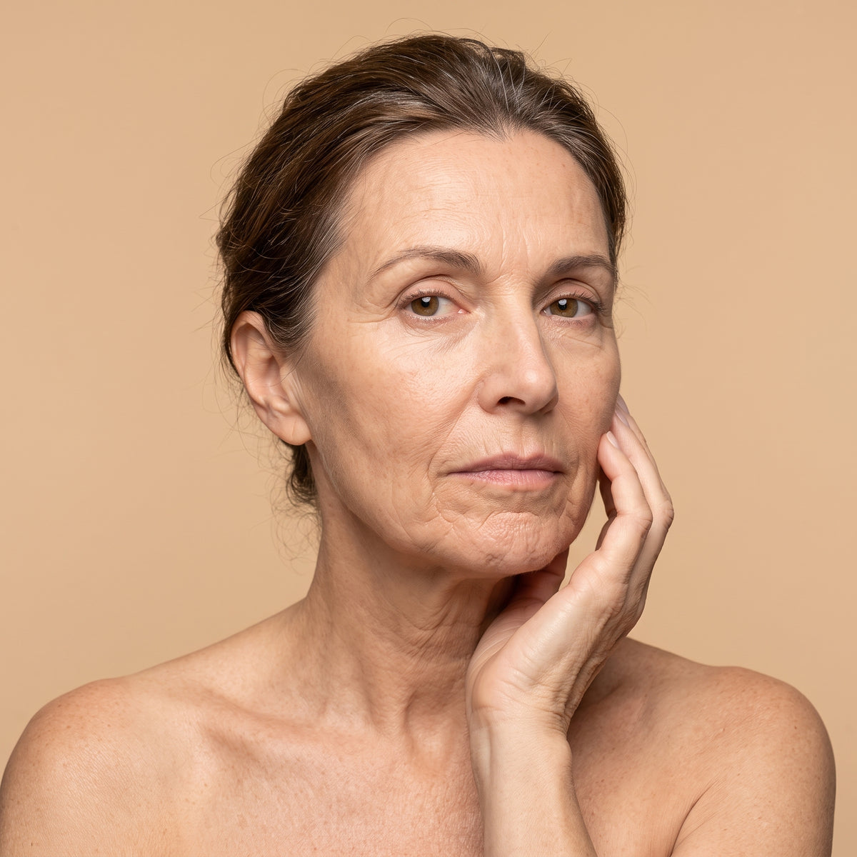 Arrugas en Mentón · Clínica Yolanda Albelda, Santiago