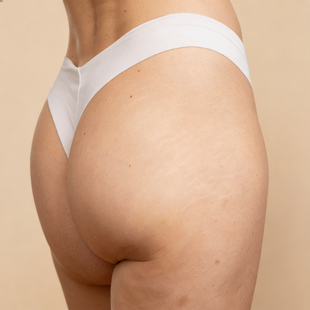 Celulitis