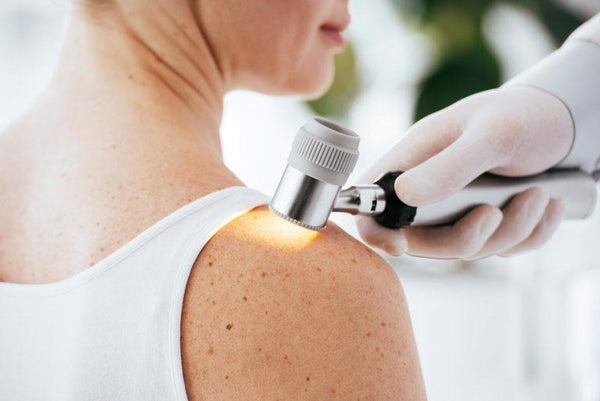 Dermatoscopio