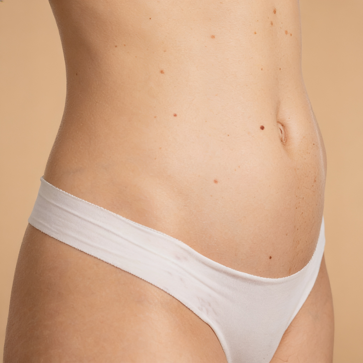 Diástasis abdominal