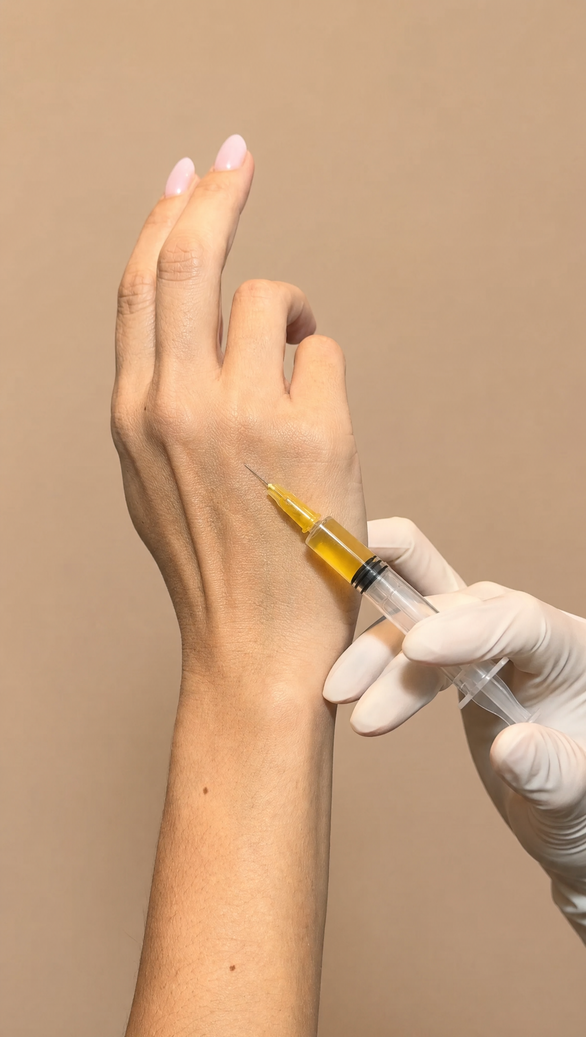 PRP (plasma enriquecido en plaquetas)