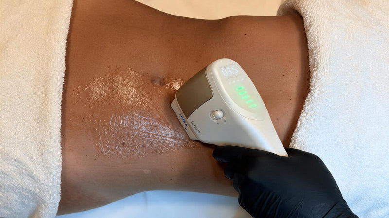 HIFU LINEA