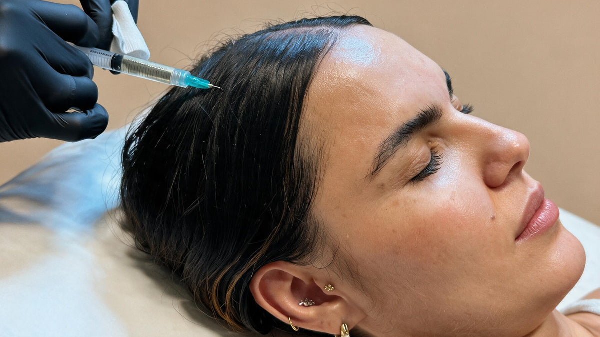 Mesoterapia capilar
