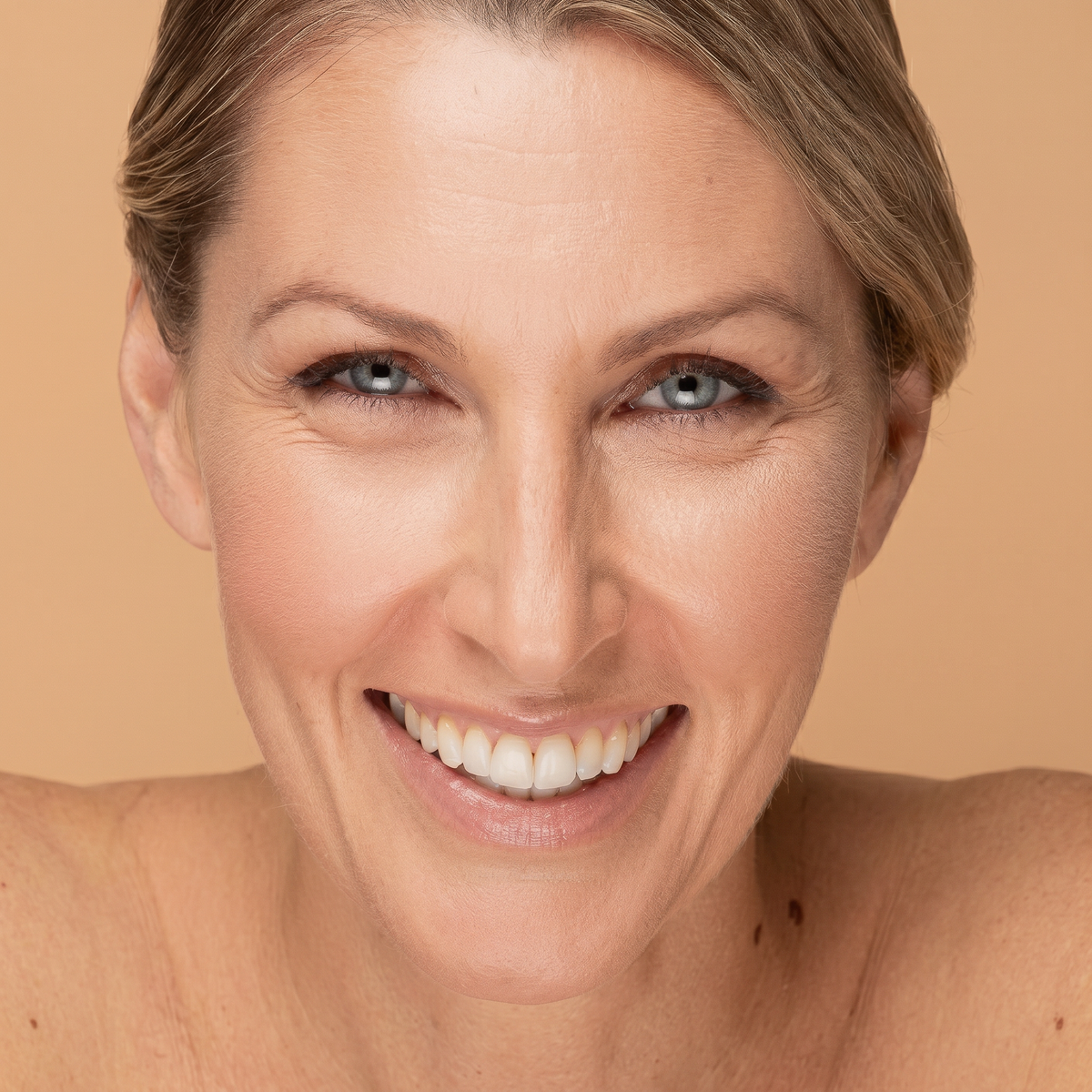 Ojeras · Clínica Yolanda Albelda, Santiago