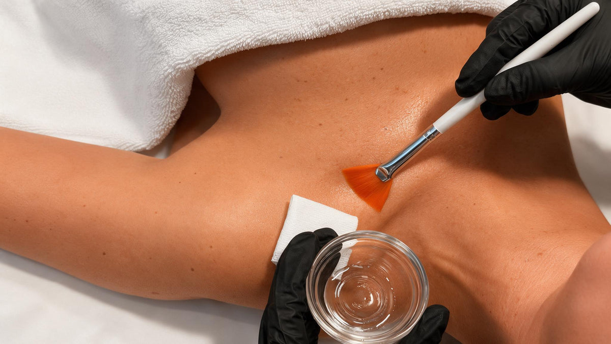 Peeling químico corporal
