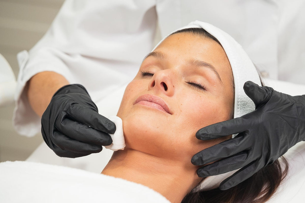 Peeling químico antiedad