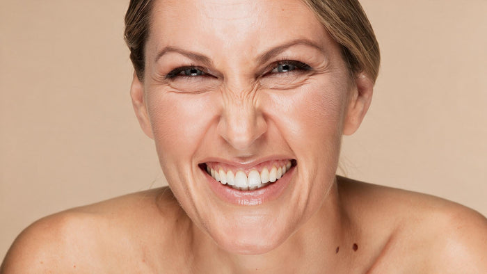 Pérdida de volumen de los labios