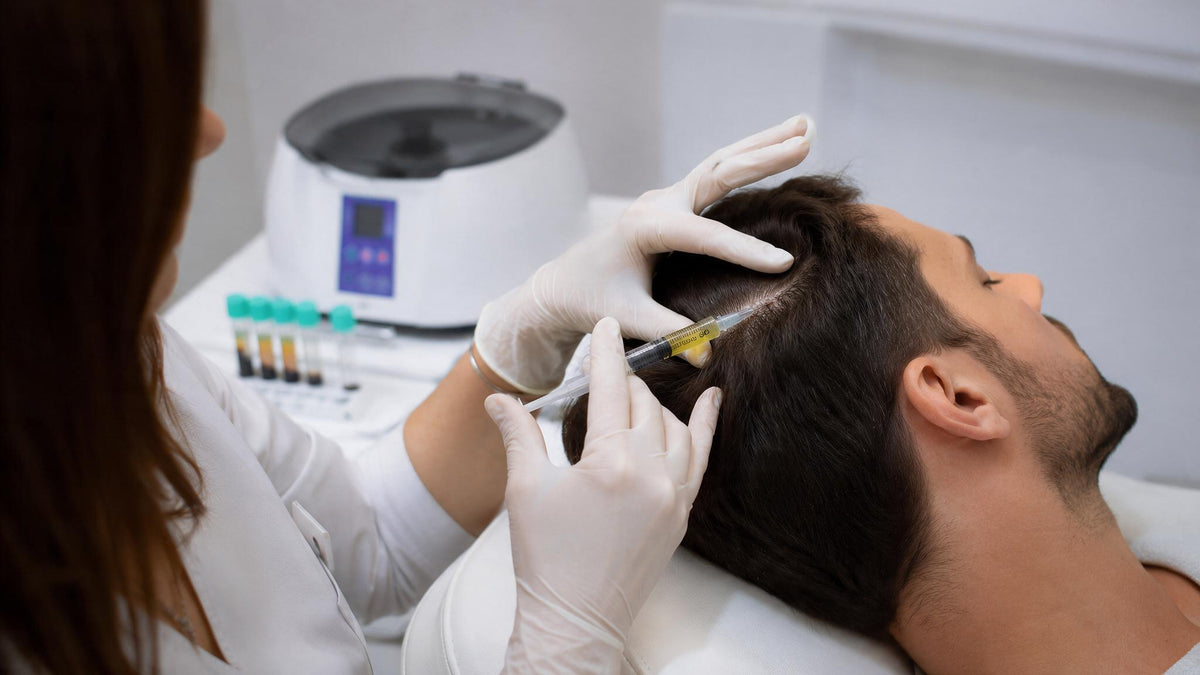 PRP (plasma enriquecido en plaquetas) capilar