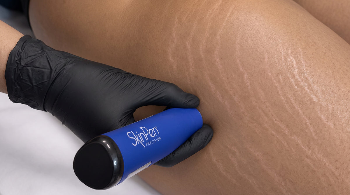 SKINPEN PRECISIÓN corporal